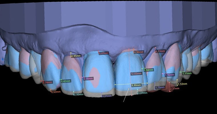 Digital Smile Design