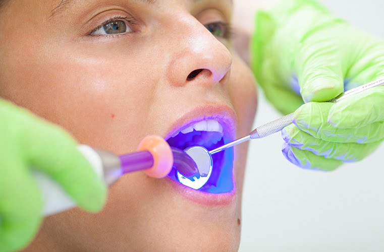 Laser Dentistry