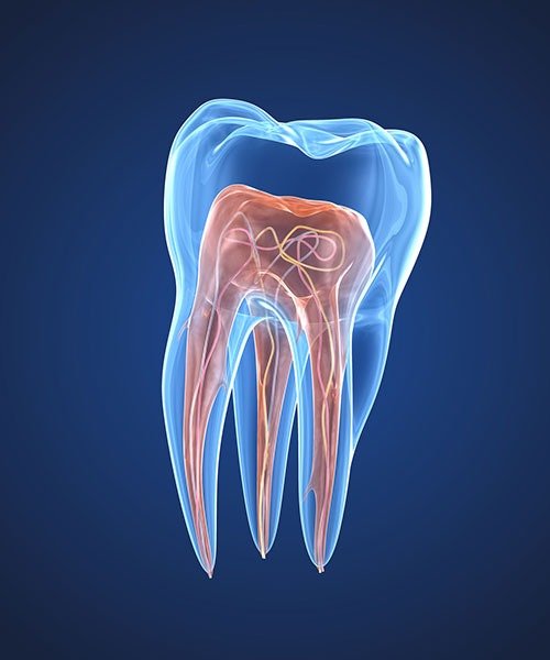 Root Canal Treatment