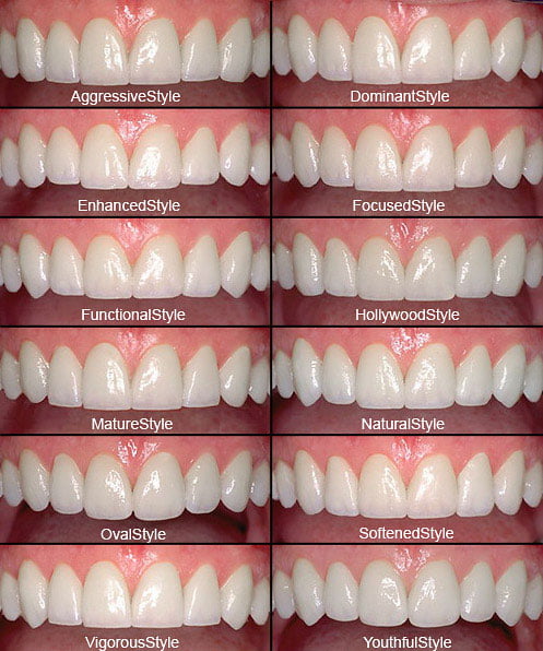 Digital Smile Design